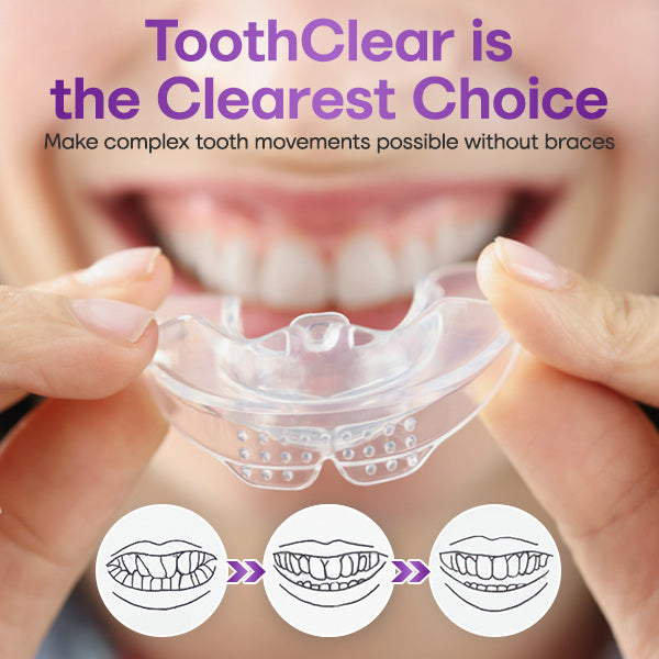 ToothClear Invisible Braces Set